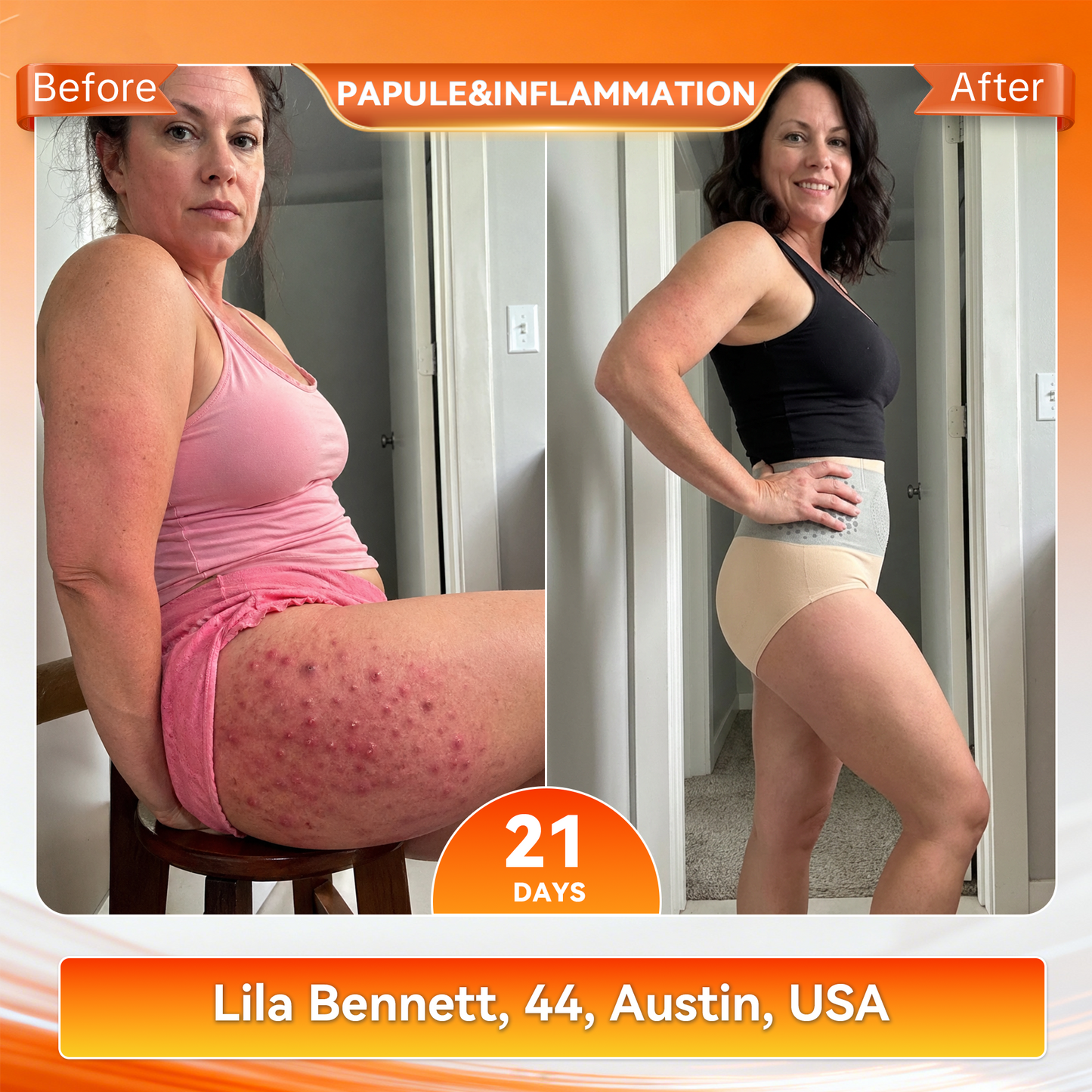 Only 5 boxes left! We're offering you an additional 30% discount! Get yourself in shape and healthy. Miss out now, and you won't have another chance until next year.