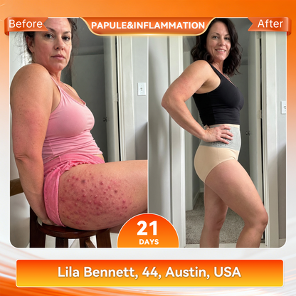 Only 5 boxes left! We're offering you an additional 30% discount! Get yourself in shape and healthy. Miss out now, and you won't have another chance until next year.