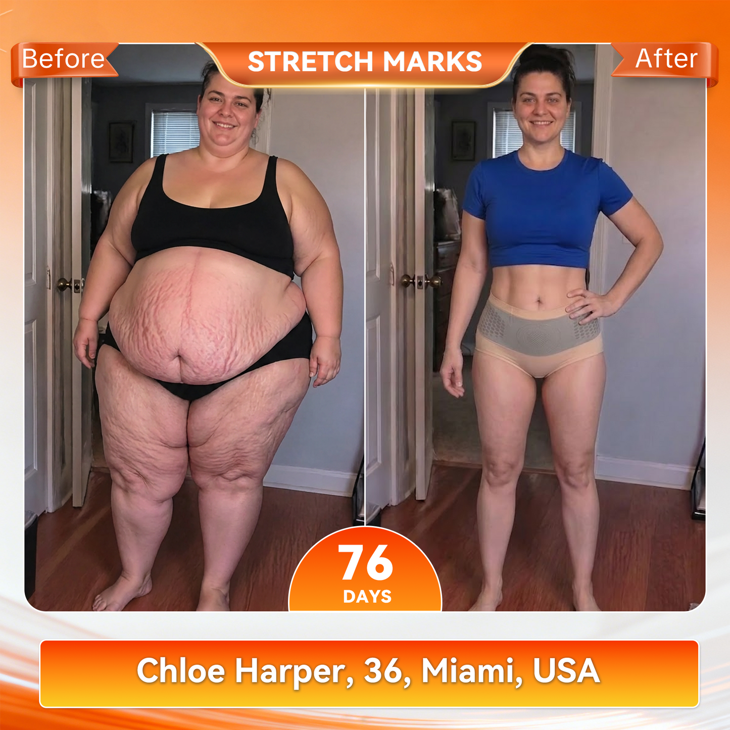 Only 5 boxes left! We're offering you an additional 30% discount! Get yourself in shape and healthy. Miss out now, and you won't have another chance until next year.