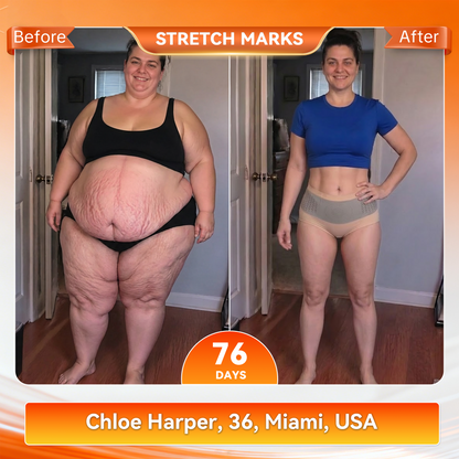 Only 5 boxes left! We're offering you an additional 30% discount! Get yourself in shape and healthy. Miss out now, and you won't have another chance until next year.
